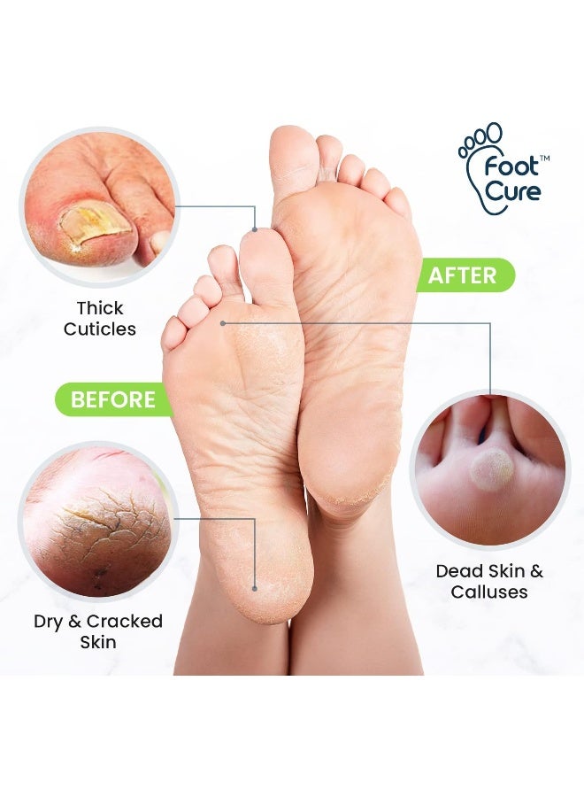 FOOT CURE Toenail Fungus Treatment Kit Extra Strength - Soak, Repair Pen & Tea Tree Balm - Image 3